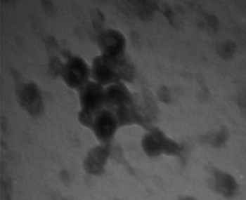 Собранная вирусоподобная частица HPV16, полученная в LEXSY (просвечивающий электронный микроскоп)